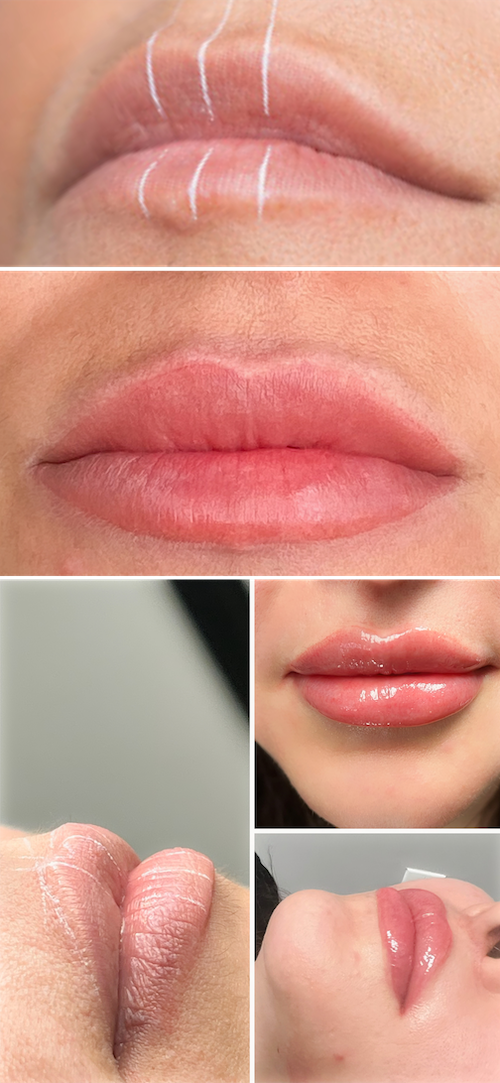 Lip Tinting - Permanent Make Up Before After